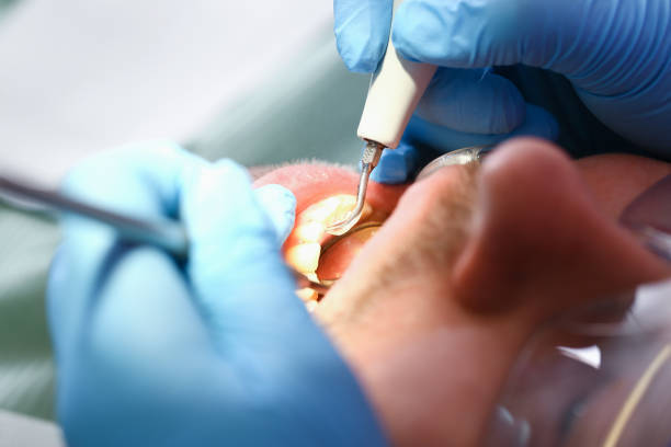 Best Weekend Emergency Dentist in Auburn, IN