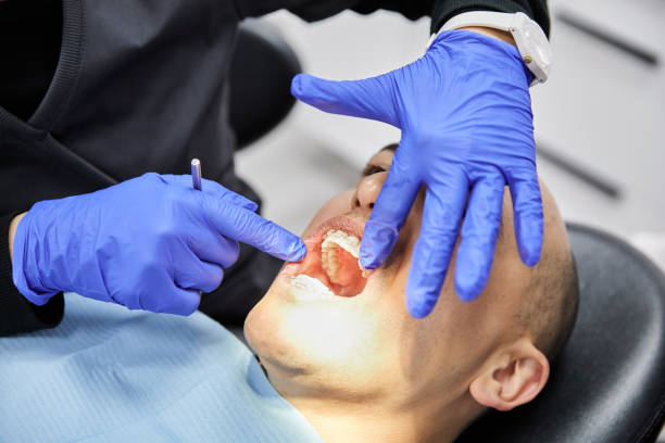 Best Emergency Dental Care for Broken or Chipped Teeth in Auburn, IN